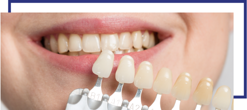 cosmetic-dentistry2